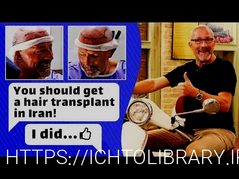 کاشت مو تهران